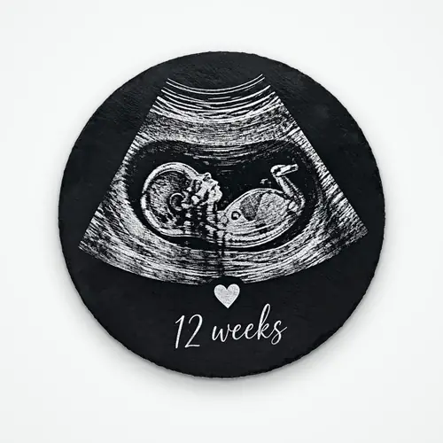 Engraved baby scan
