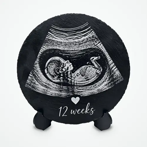 Baby scan, on its stand